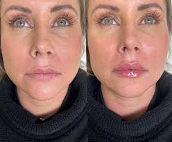 Sheila Cannon RN BSN (@beautynurse_sheila) • Instagram photos and videos