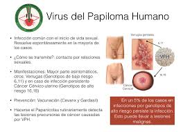 Conoce remedios caseros y naturales para eliminarlas. Facebook