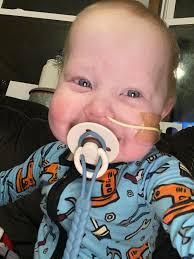 Water kefir and Coumadin interaction concerns