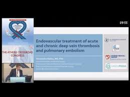 Although most dvt is occult and resolves spontaneously without complication, death from treatment. Endovascular Treatment Of Acute And Chronic Deep Vein Thrombosis And Pulmonary Embolism Vascupedia