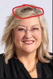 OMG just updated Evoto… THERE IS A FEATURE TO REMOVE ARMPIT FAT!!! What is  this sorcery?! 😭😭 I'm SO GLAD I decided to give this software a try.