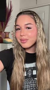 Madelyn Francesca Surgery