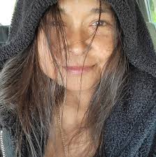 How long to wait before cuddling with dogs after kidney transplant?