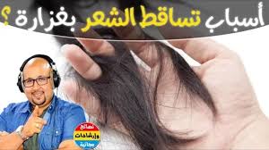 أسباب تساقط الشعر والوصفة التي يبحث عنها الجميع للحد منه مع الدكتور عماد ميزاب Incoming Call