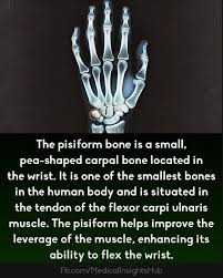 Image result for Pisiform Bone