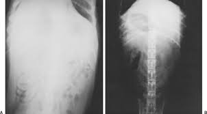 Radiographic Quality Veterian Key