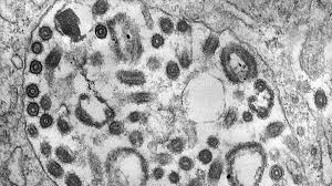 Un fármaco es prometedor contra un virus similar al ébola. 1r4f37rkhqb7bm
