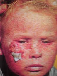 Második rész –KÉPES KISMAMA BLOG