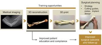 If f is convex and x is a critical point of f , then x is a local minimizer. Additive Manufacturing Pertaining To Bone Hopes Reality And Future Challenges For Clinical Applications Sciencedirect