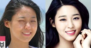 Korean Idol Before And After Makeup Saubhaya Makeup