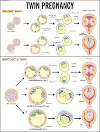 twin pregnancy for nursing chart