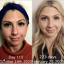 Serum hỗ trợ trị nám da Admire my skin