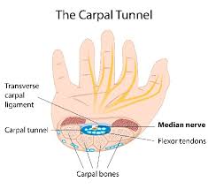 Geelong Medical Plastic Surgery Carpal Tunnel Syndrome