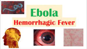 Ebola hemorrhagic fever, transmission, ebola hemorrhagic fever: Overview Of Ebola Hemorrhagic Fever Causes Pathophysiology Symptoms Diagnosis Treatment Youtube