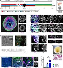 Modeling Parkinson S Disease In Midbrain Like Organoids Npj Parkinson S Disease