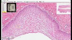 Maybe you would like to learn more about one of these? Non Keratinized Stratified Squamous Epithelium Youtube
