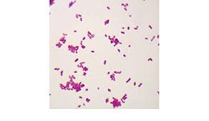 Typhimurium is positive for citrate test typhi is negative. Salmonella Typhimurium W M Microscope Slide Science Lab Microbiology Supplies Amazon Com Industrial Scientific