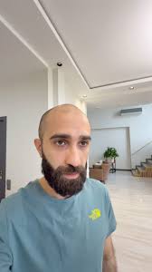 Ürəyim ağrayır bizə🥲, @aviasales.az -dan ucuz bilet alan kimi, ağrı keçir