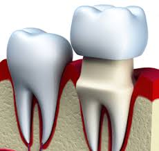 Dental care group pembroke pines. Dentist Pembroke Pines Fl Dental Care Pines Dental Associates