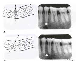 We did not find results for: Object Localization Pptx Dr Rand Muhadharaty