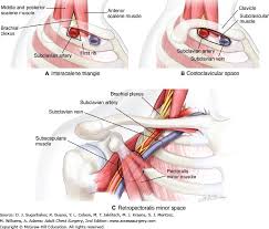 Thoracic Outlet Syndrome Shoulder Elbow Orthobullets