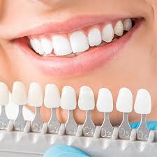 Cosmetic Dentistry Littleton Teeth Whitening Porcelain