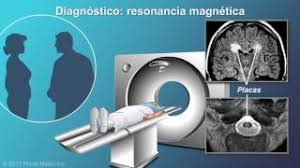 Las resonancias seriadas nos dan. El Diagnostico De La Esclerosis Multiple