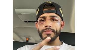 UFC 273 Official Scorecard: Aljamain Sterling vs. Petr Yan 2