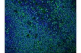 The camel igg elisa is an enzyme immunoassay (elisa) for the quantitative determination of igg 1, 2 and 3 in plasma or serum of the camel. Anti Rat Secondary Antibodies Www Antibodies Online Com