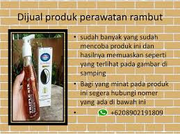 Terlarisss Wa 6289602191809 Rambut Tipis Botak In 2020