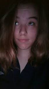 Dancer with cerebral palsy