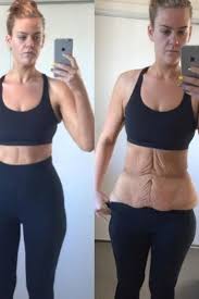 Woman Shuts Up Her Body Shaming Haters On Social Media 12 Week Body Transformation Transformation Body Sleeve Surgery