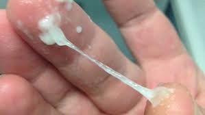 The white discharge before your period is actually a form of mucus that is naturally produced from the neck of the womb—scientifically called the cervix. What Can Cause A Watery Discharge During Ovulation Quora