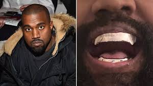 Kanye West debuts bizarre $850,000 titanium grills after having his teeth  removed - The Mirror US