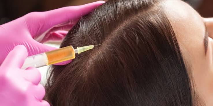 GFC PRP Hair at Namaa Clinics