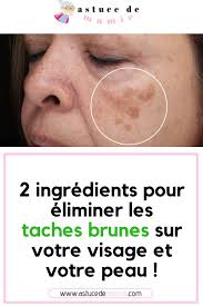 Pin On Beaute Sante Au Quotidien