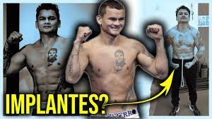 Chino maidana, el combate que paralizaría al boxeo argentino. Los Implantes Abdominales Del Chino Maidana Youtube