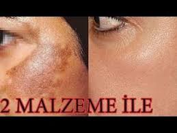 15 Dakikada Leke Giderici Sikilastirici Kirisik Acici Dogal Maske Tarifi Guzellik Bakim Youtube Cilt Tedavileri Maskeler Dogal Cilt Bakimi