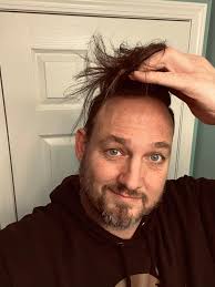 Most people thought I didn't have hair because I wear a hat in my videos.  Well… now it's gone and I LOVE IT!!!