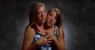 In 2007, george, who was at that time known as reba schappell, stated that although he was born female. 6 Oldest Living Conjoined Twins In The World Oldest Org
