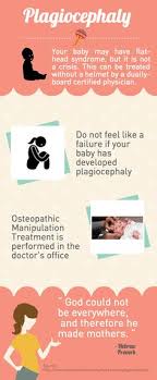 87 Alternative To Baby Helmets Plagiocephaly Omt Ideas Baby Helmet Flat Head Syndrome Osteopathy