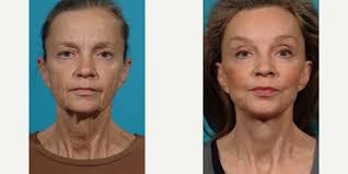 Jay Burns, MD, Board Certified Plastic Surgeon