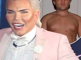 Maybe you would like to learn more about one of these? Rodrigo Alves Was Unhappy Before Surgery And Transformation Into Human Ken Doll As Celebrity Big Brother Star Opens Up On Procedures Ok Magazine