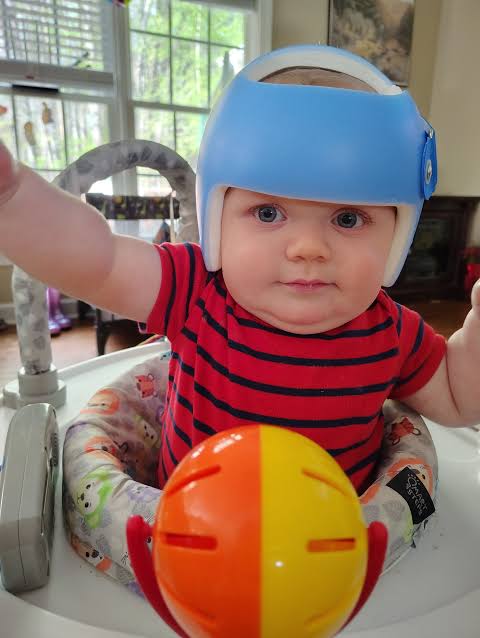 One week down in the helmet! 💪🏼 #helmetbaby #preemie #physicaltherapy