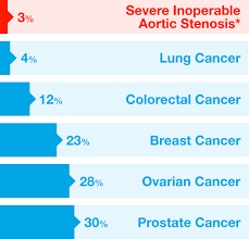 aortic stenosis prognosis new heart valve hcp