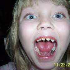 zoe becker (@zcat06)