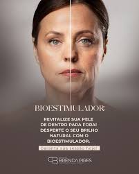 O Beauty Day chegou para cuidar da sua pele de forma única e especial! 🌟  Os procedimentos mais desejados agora com condições exclusivas em um evento  pensado especialmente para você: ✨ Botox