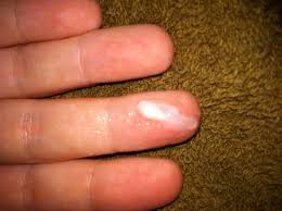 Is cramping after ovulation 7. Cm After Ovulation Guide To Cervical Mucus