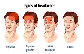 Image result for Acute Recurrent Headache
