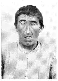 L'Alienato, di alienazione e di riscatto sociale. — Manicomio di Volterra